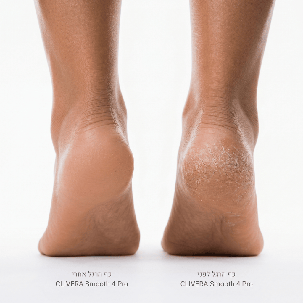 CLIVERA Smooth 4 Pro